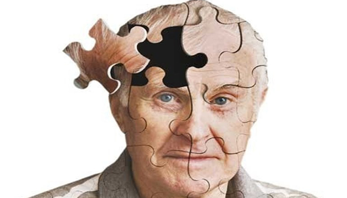 تشخیص آلزایمر با بازیهای ویدئویی