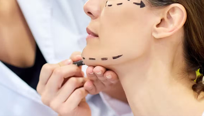 عوارض لیفت صورت با نخ: زیبایی یا فریب؟