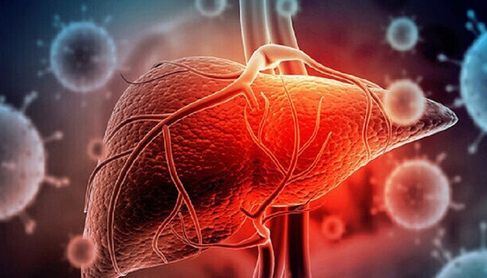 کبد چرب قابل درمان است؟