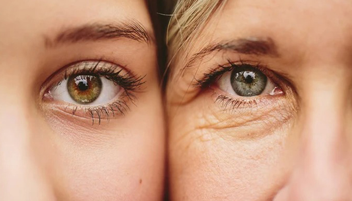 پیری زودرس چیست؟ شناخت علل، نشانه‌ها و راهکارهای علمی پیشگیری