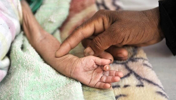 یارانه کودکان دارای سوء تغذیه شارژ شد | جزئيات کامل مرحله چهارم حمایت معیشتی