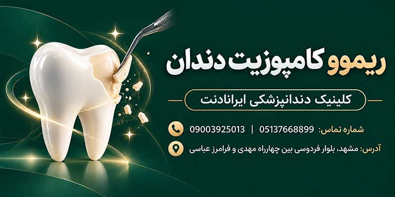 ریموو کامپوزیت دندان و برداشتن مواد کامپوزیتی از سطح دندان در کلینیک دندانپزشکی ایرانادنت